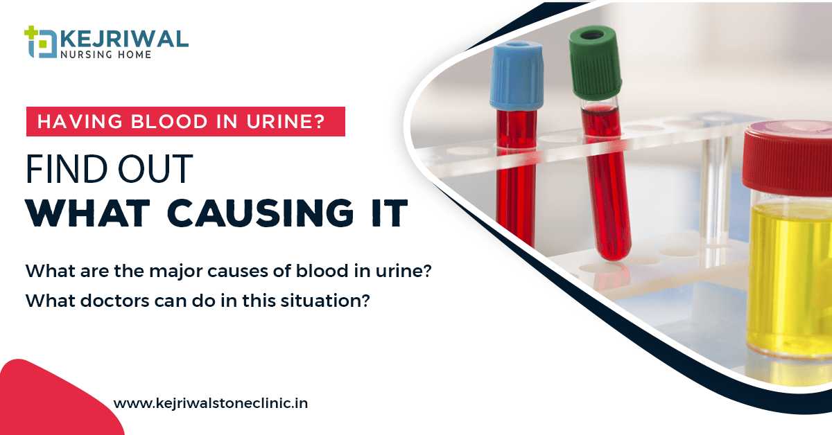 Having Blood in Urine? Find Out What Causing It