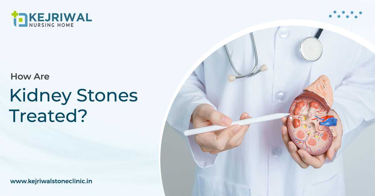 Symptoms And Treatments of Kidney Stones