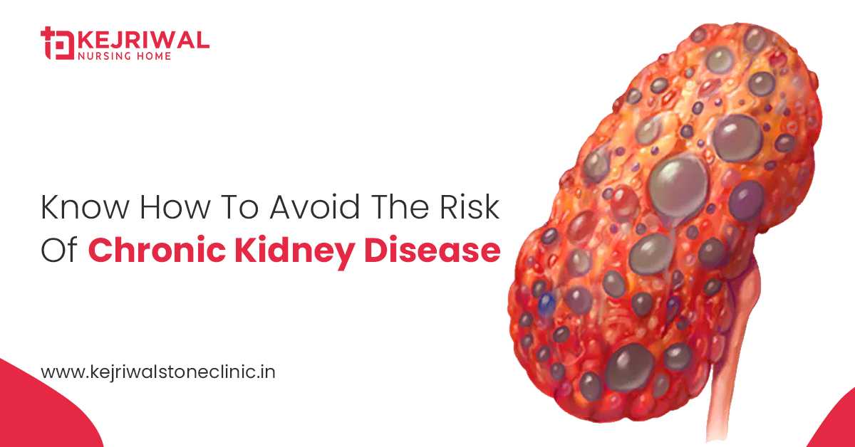 Visit A Kidney Hospital To Avoid The Risk Of Chronic Kidney Disease