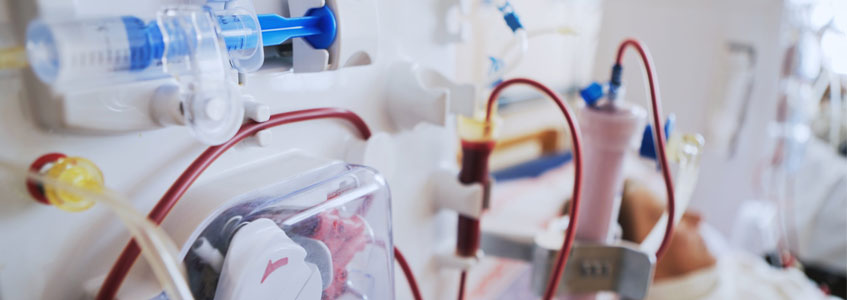 Best Dialysis Centre in Siliguri