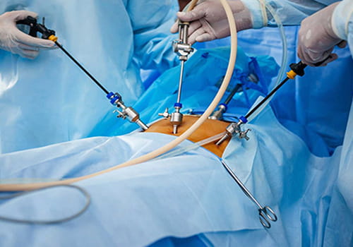 Laparoscopic Surgery